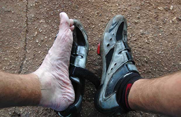 Early signs of possible trench foot if left untreated and the feet aren't dried out.